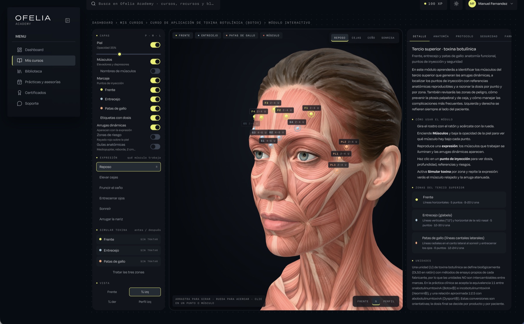 Módulo interactivo 3D del curso de toxina botulínica: rostro con la capa muscular visible, puntos de inyección de Botox en frente, entrecejo y patas de gallo con su dosis